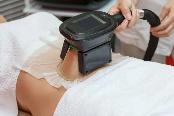 Image of person having fat freezing treatment to help weight gain Cambridgeshire