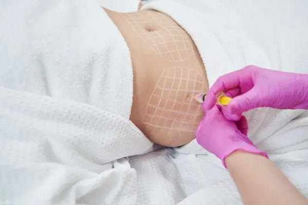 image of fat dissolving injections on love handles to help combat weight gain Cambridgeshire