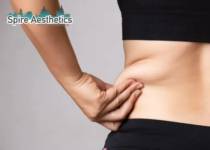 Image of woman pinching fat on their hips Cambridgeshire. Fat Freezing treatment