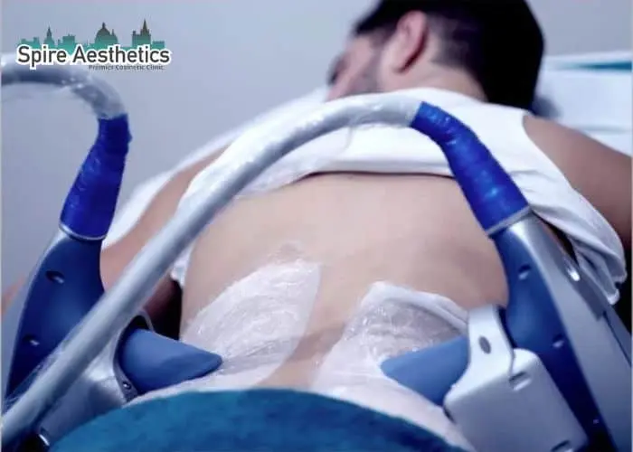 Man having fat freezing treatment done on love handles before a competitions Cambridgeshire to create a sculpted look.