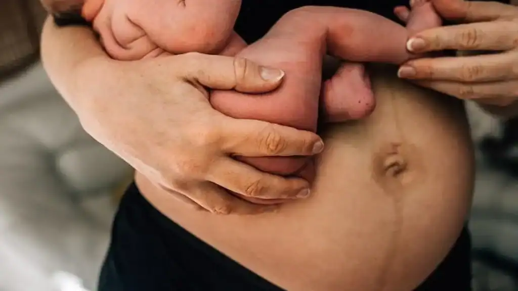 Why Is My Stomach Still Big After Pregnancy Cambridgeshire?